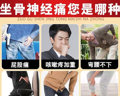 坐骨神经痛（了解坐骨神经痛的常见症状及有效的治疗方法）