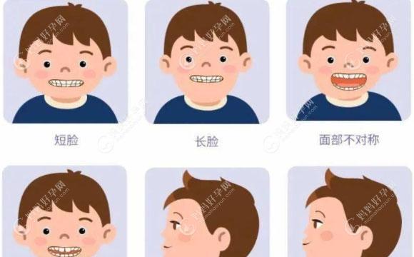 拥有完美笑容的小技巧（改善龅牙的15个小妙招）