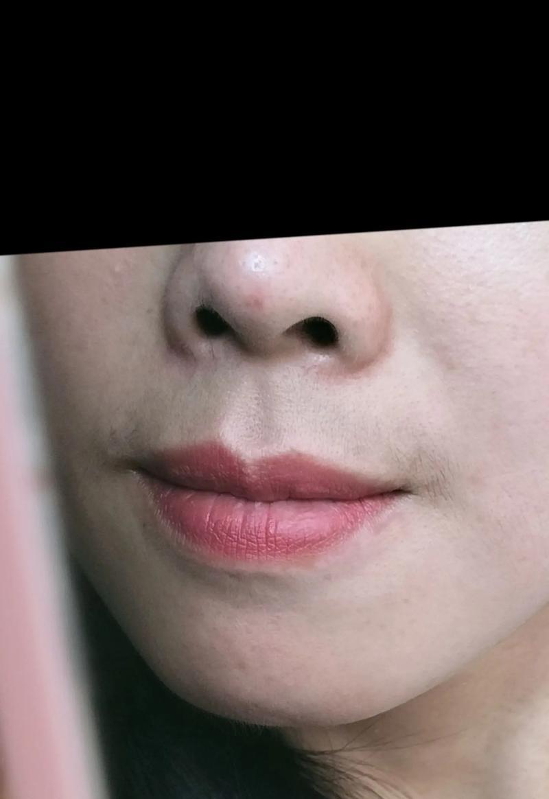 女生有胡子怎么办（去除女性脸部毛发的方法）